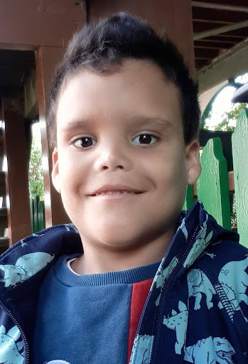 Headshot of a young boy who lives with a condition called Nascimento X-linked intellectual disability