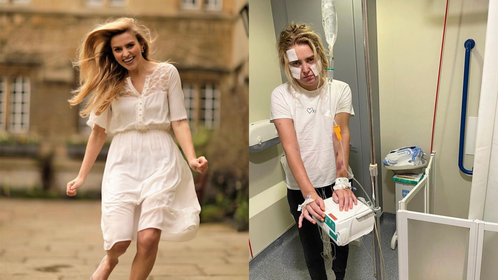 two photos of Tilly comparing when she is well to when she is in a hospital