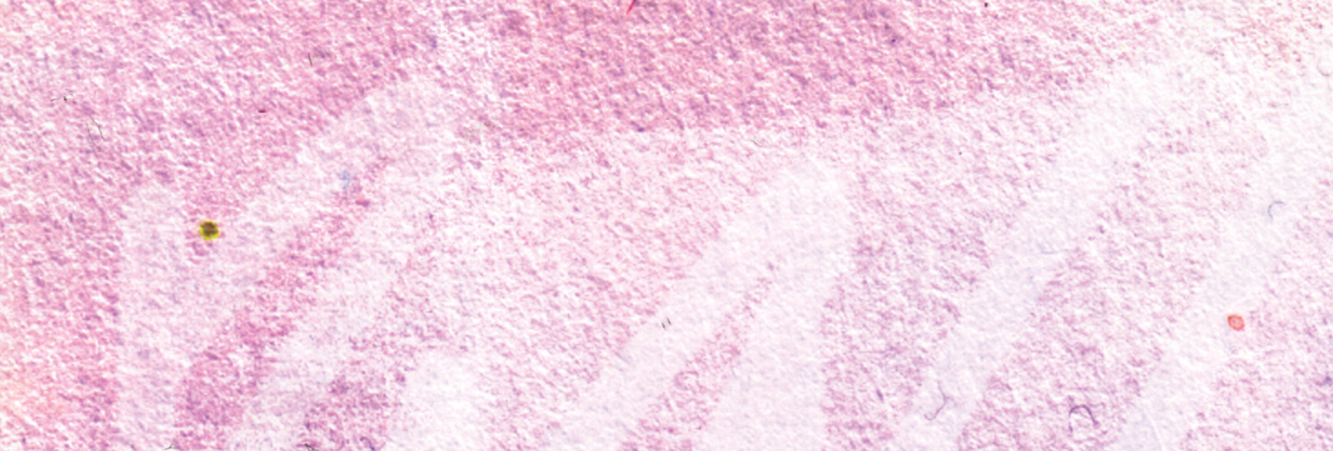 close up of pink paint from jonatha's submission to More than you can imagine: an anthology of rare experiences. Prioduced by Genetic Alliance UK for Rare Disease Day 2025